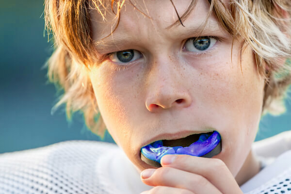 mouth-guard blue